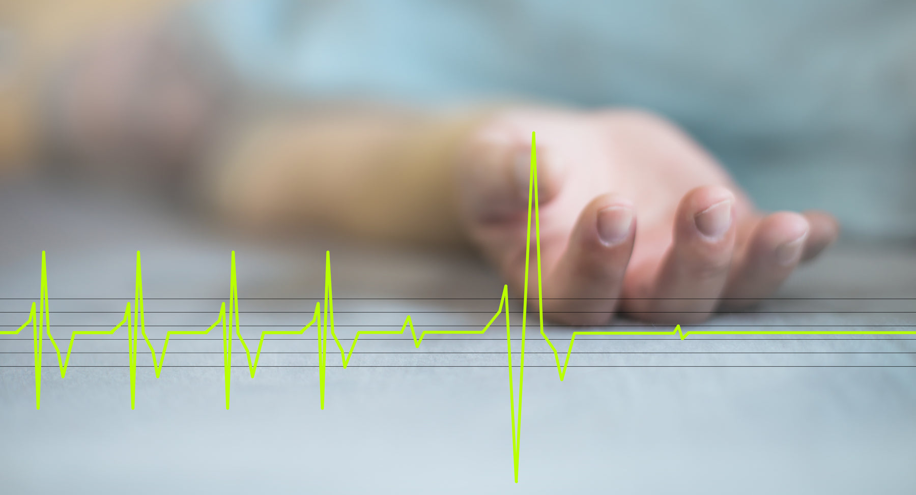 How do you know if someone is experiencing a Sudden Cardiac Arrest (SCA) and what do I do?
